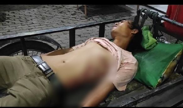 Korban Ahmad Firdaus menjalani perawatan medis di RS Bhayangkara Medan