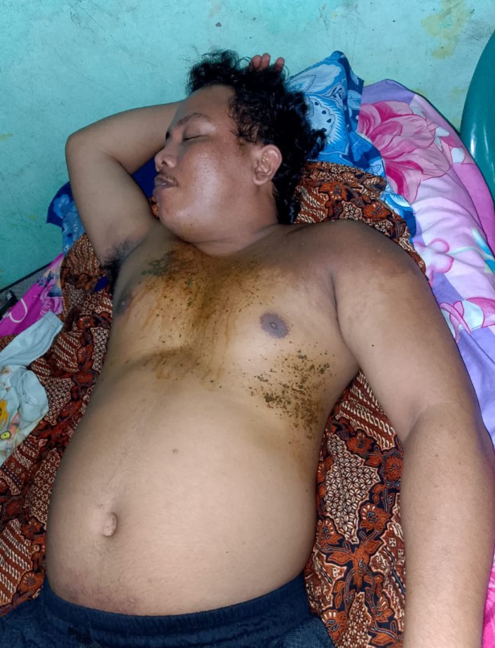 Korban Desak Penyidik Limpahkan Berkas Tersangka Oknum Polisi SN dan Dua Anaknya ke Kejari Madina