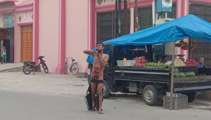 Seorang Pria Nekat Gorok Leher Sendiri di Medan Tembung